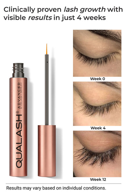 QUALASH® Advanced Eyelash Growth Serum with visible lash enhancement results and showing timeline before &amp; after
