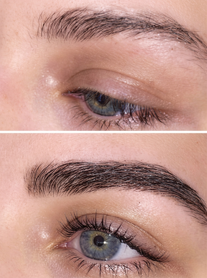 Before and after eyebrow transformation results after regular use of QUABROW® brow serum
